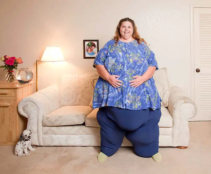 History Of Heaviest Humans As World S Biggest Man Loses Half His Body Weight Guinness World