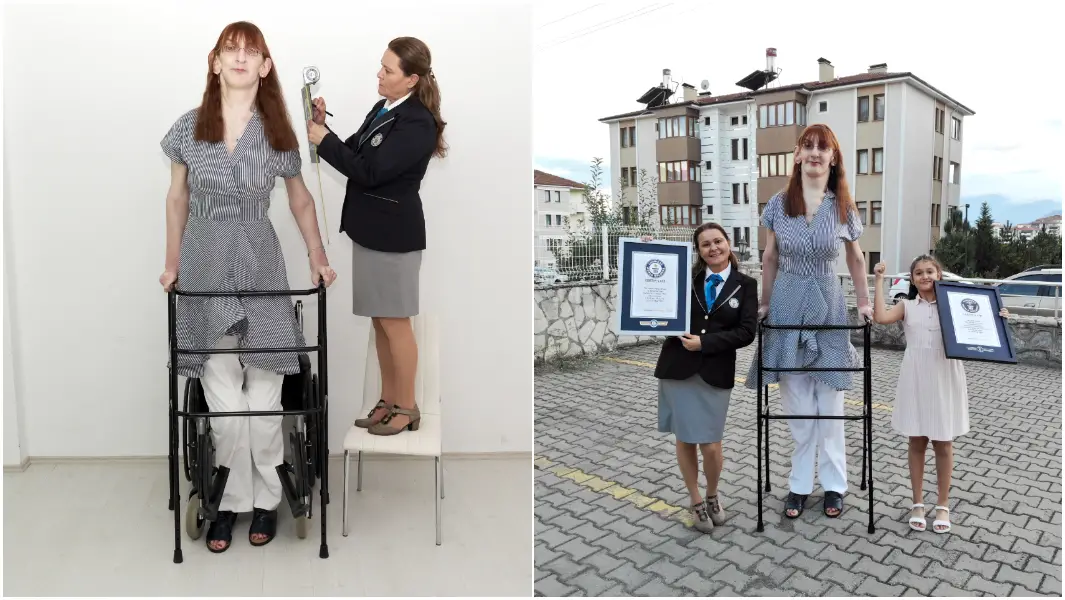 Turkey&#39;s Rumeysa Gelgi confirmed as tallest woman living | Guinness World  Records