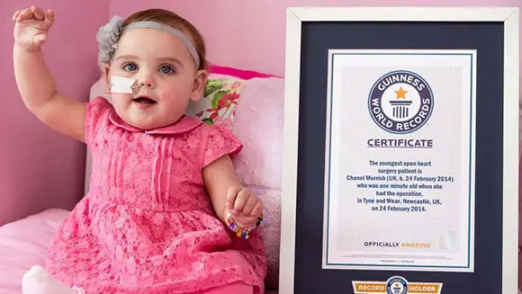 guinness world records smallest baby