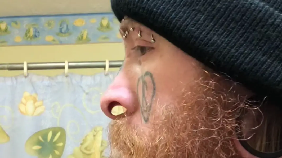 “Patience is the key”: Man with largest nasal septum flesh tunnel stretched it 2.6 cm