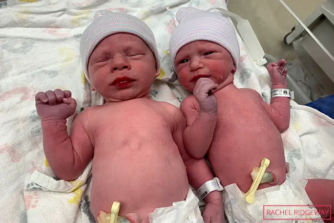 image-of-twins-timothy-and-lydia-ridgeway-as-newborn-babies.jpg