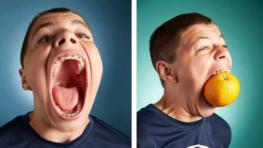 Minnesota teen reclaims record for largest mouth gape Guinnes image