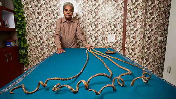 Murari Mohan Aditya, Guinness World Record Holder for Longest Fingernails -  Calcutta (Kolkata) 1969 - Old Indian Photos