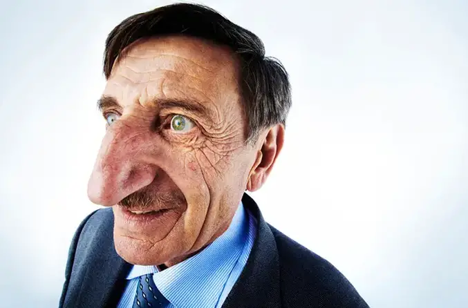 mehmet ozyurek had the longest nose on a living person