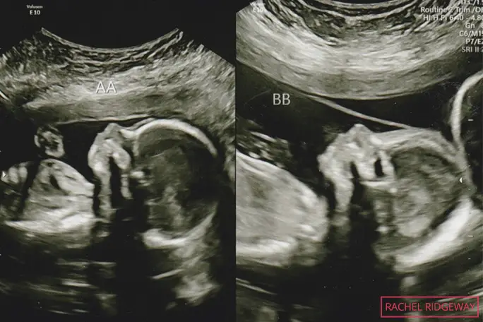 ultrasound-scans-of-timothy-and-lydia-ridgeway.jpg
