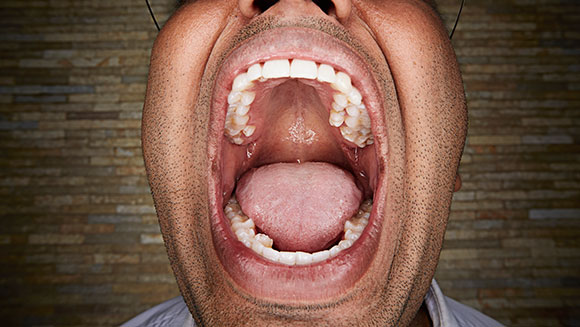 most-teeth-in-the-mouth-header