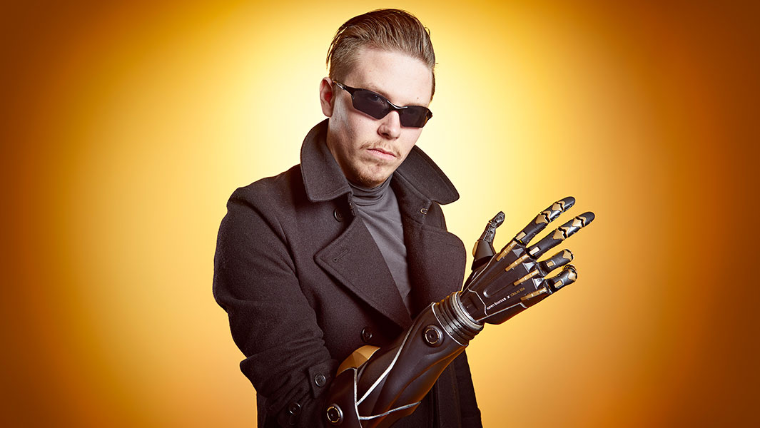 First prosthetic limb based on a videogame header