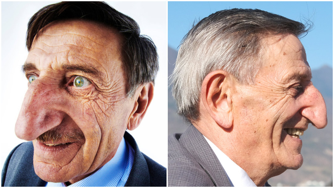 longest nose split image 2013 and 2021