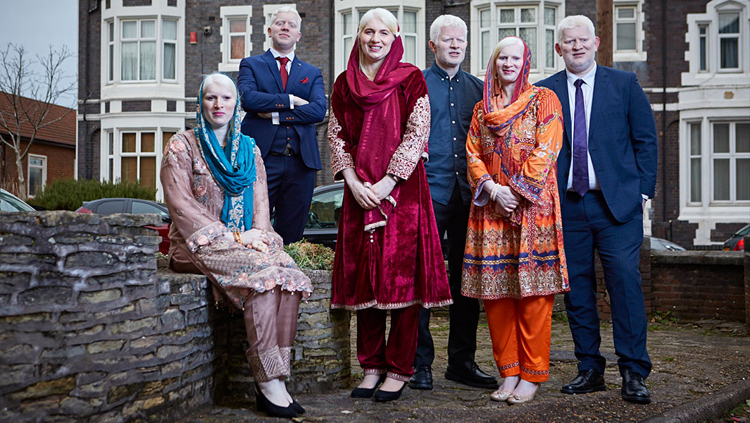 Haider Ali GWR Most Siblings With Albinism outside stone wall