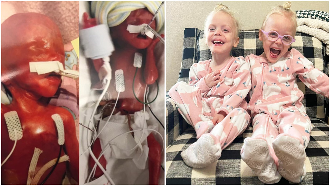 split image of keeley and kambry when first born and at three