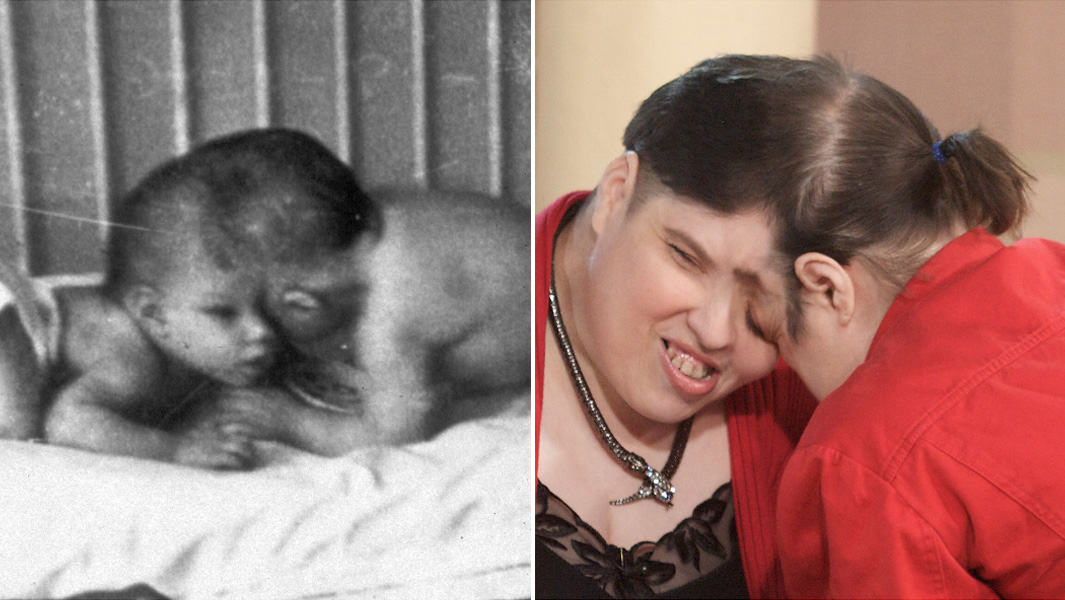 split image of Shapell twins