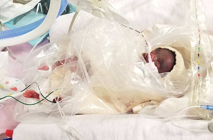 Adrial immediately after birth