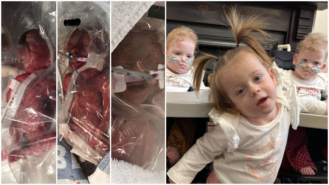split image of most premature triplets