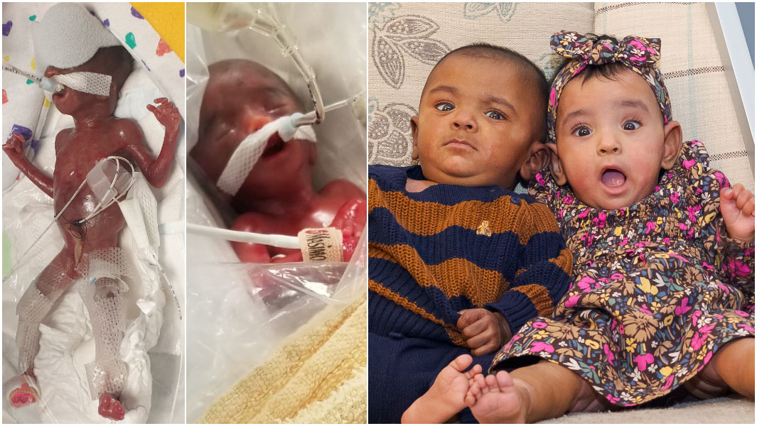 split image of worlds most premature twins