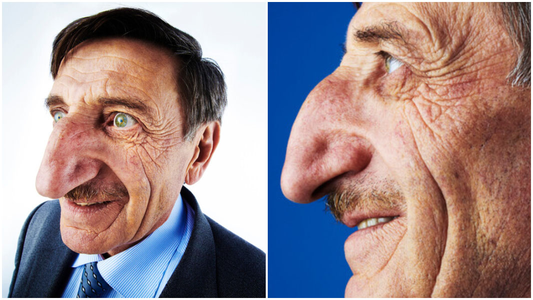 mehmet ozyurek split image