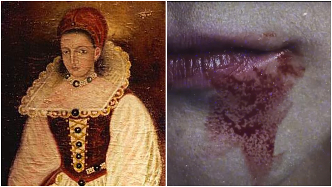 split image of Elizabeth bathory and a bloody mouth