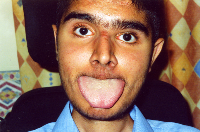 Amandeep Heer's tongue measured 7.6 cm (3 in) in width Amandeep Heer's tongue measured 7.6 cm (3 in) in width