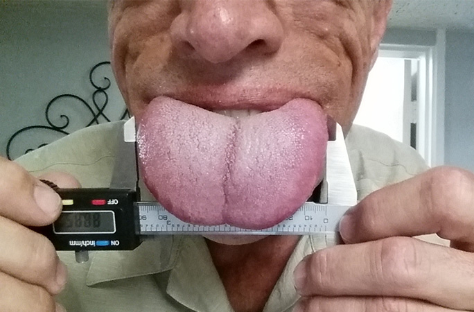 Brian Thompson's tongue is 8.88 cm (3.49 in) wide Brian Thompson's tongue is 8.88 cm (3.49 in) wide