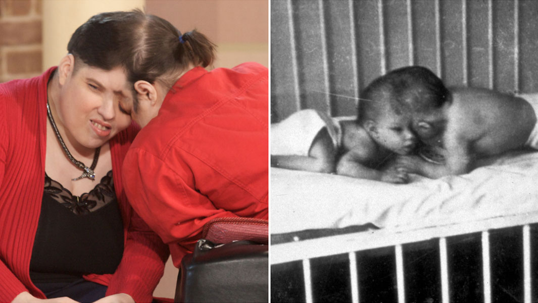 lori and george schappell split as adults and babies