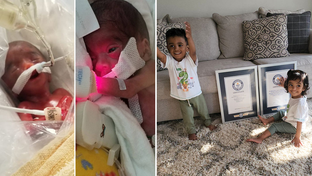split image of most premature twins