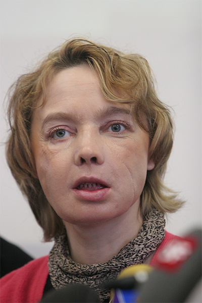 Isabelle Dinoire