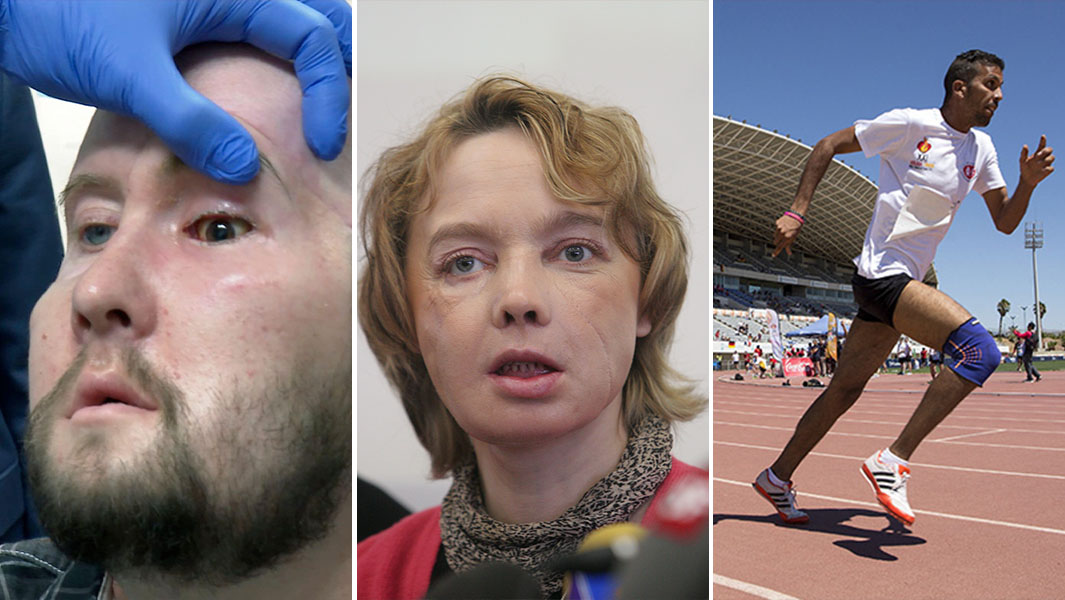 split image of transplant patients following procedures and on a running track
