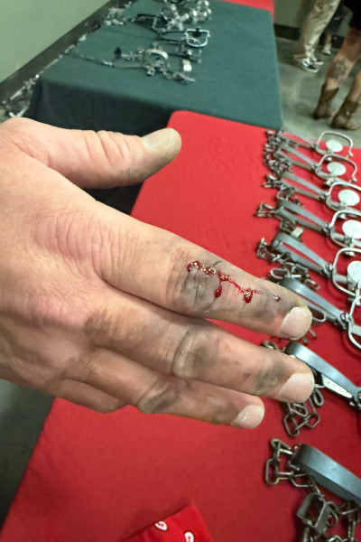 Casey's bleeding hand