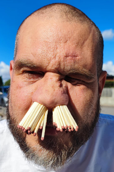 Martin with matches in his nose