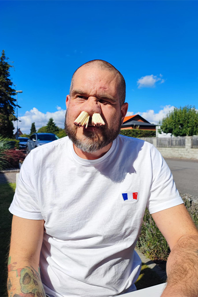 Martin with matches up his nose