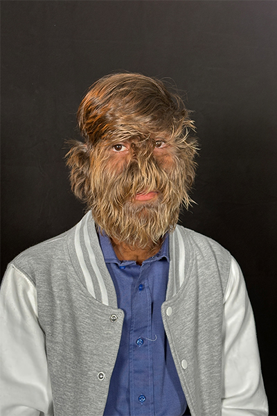 Lalit's face is covered in hair