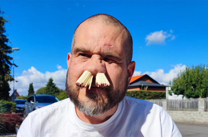 Martin with matches in his nose