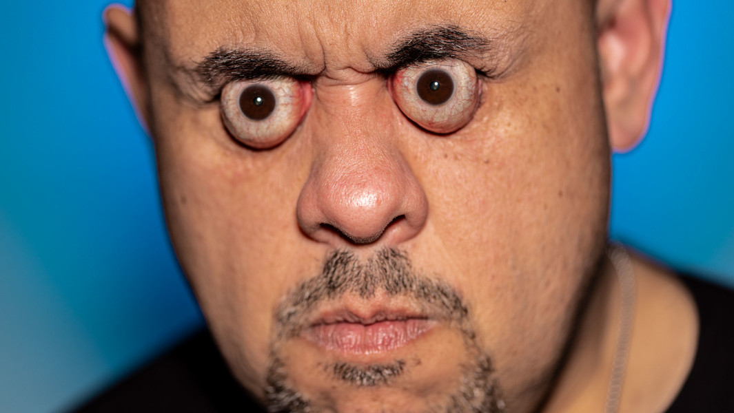 Close up of Williams Lopez's eye pop