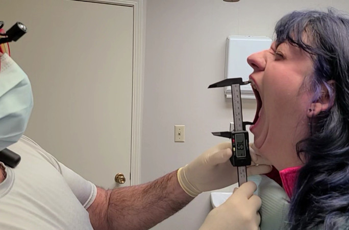 Dentist measuring Maries mouth with calipers