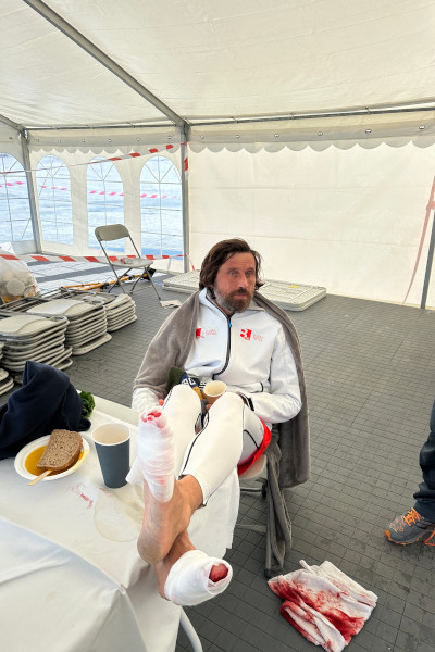 Pawel's bloody feet after the race