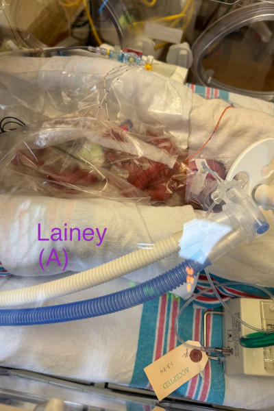 Lainey at birth