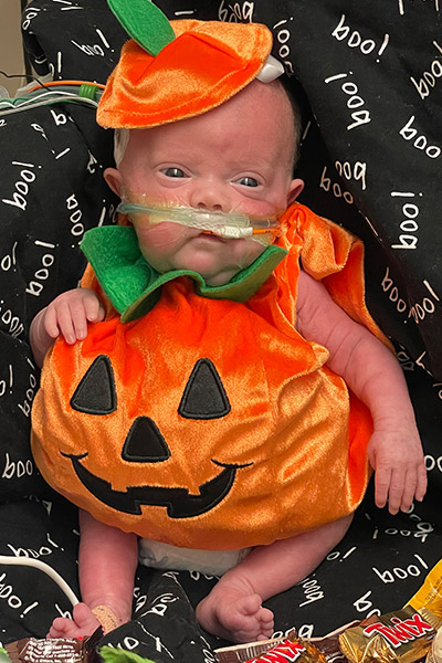 Nash Keen, most premature baby, dressed as a pumpkin for first Halloween, aged three months