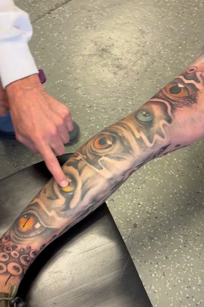 The new eyes on Chad's leg