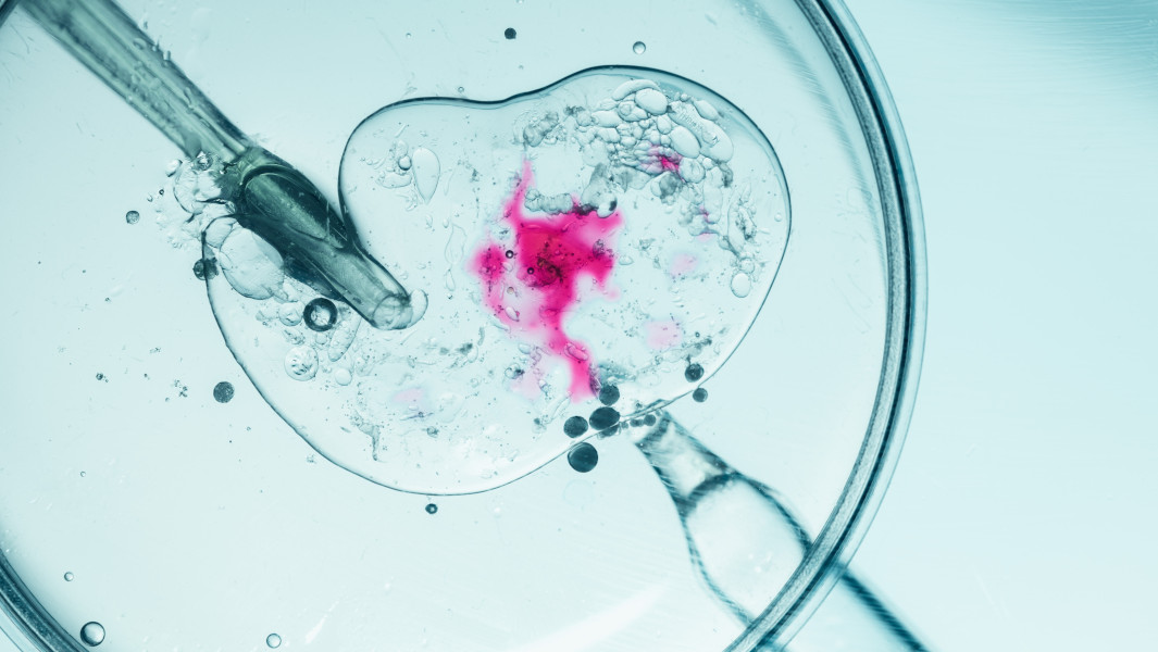 Stock image of an IVF procedure