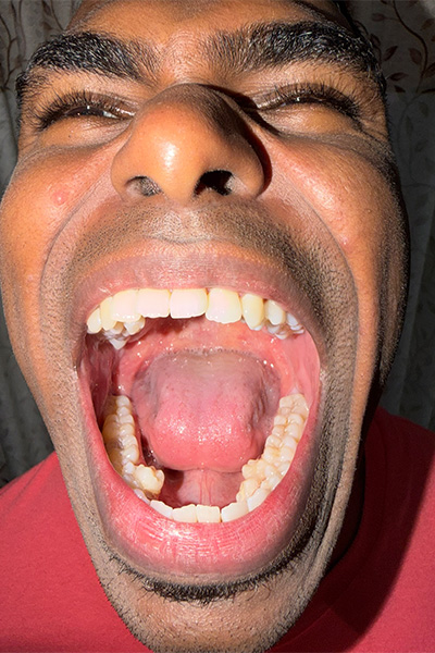 Prathab with his mouth open