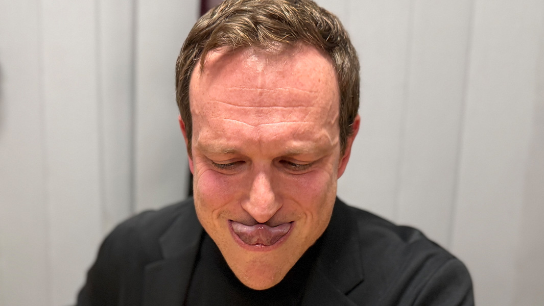 split image of Sacha inflating his tongue and touching his nose with his tongue