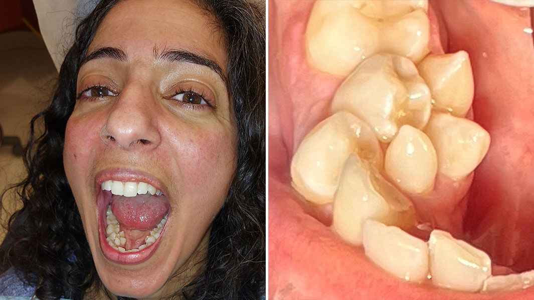 Split image of Sylvia in the dentist chair and a close up of her teeth