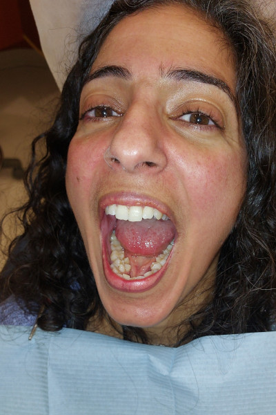 Sylvia smiling in the dentist chair