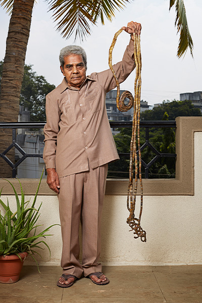 Shridhar holding up his hand to show off his fingernails