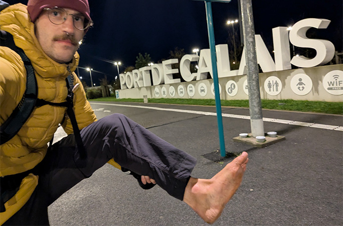 Eamonn holding up his bare foot in Calais