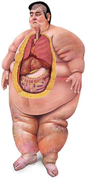Illustration of heaviest man