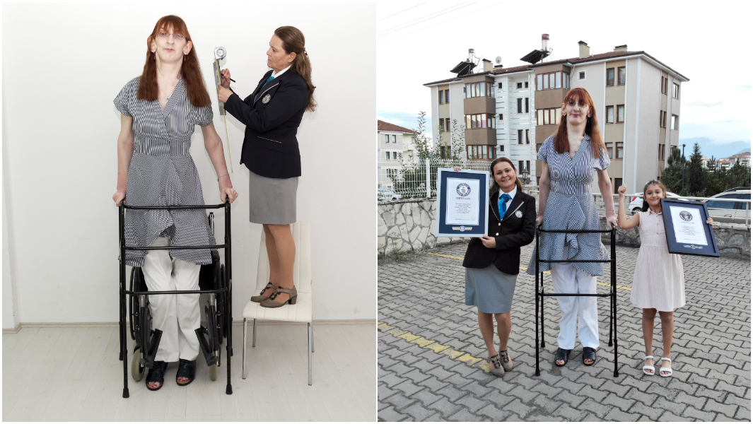 Rumeysa Gelgi's life in pictures and measurements: Track how tallest woman living grew | Guinness World Records